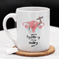 Hysterectomy Gift, Coffee Mug: You're Hyster-y I'm So Ovary You